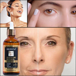 SERUM DE RETINOL - ANTIARRUGAS + REGALO JABON DE CURCUMA PARA EL ACNE